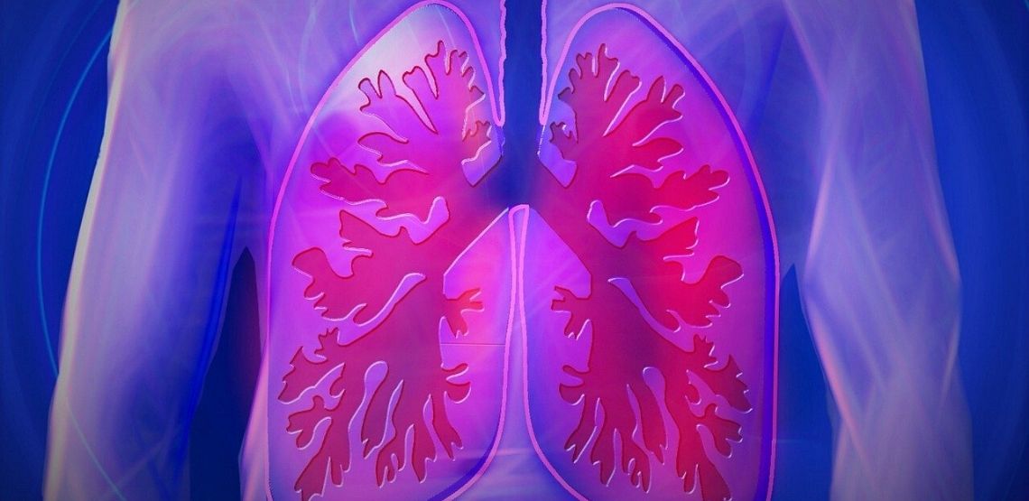 A graphic of lungs.